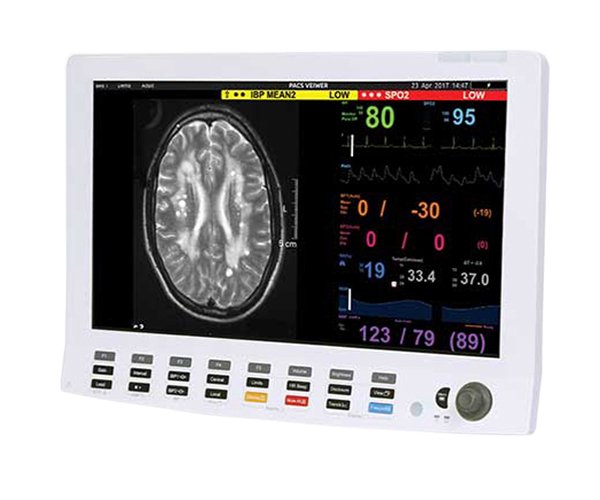 vital signes monitors2